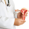 Endometrioza